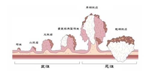 16d5ad9cd03ed92f4.jpg